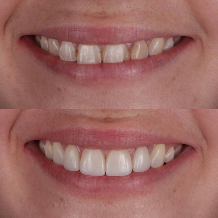 Dentistry On The Square, Pain Free Dentist Glasgow - Smile Gallery