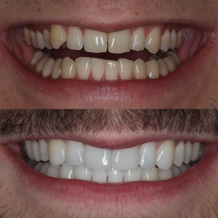 Dentistry On The Square, Pain Free Dentist Glasgow - Smile Gallery