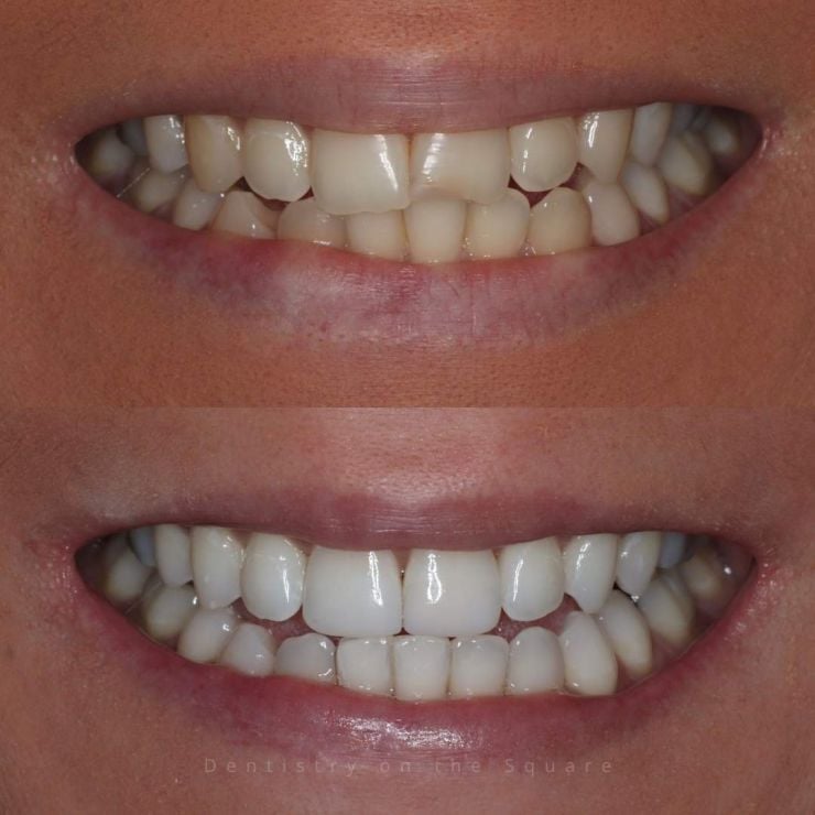 Transforming Smiles