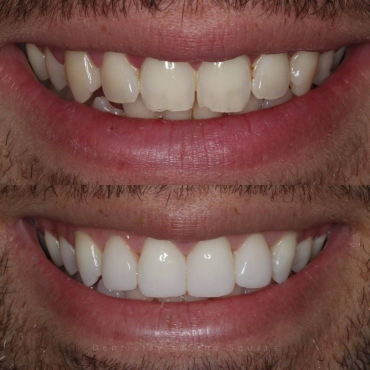 Transforming Smiles