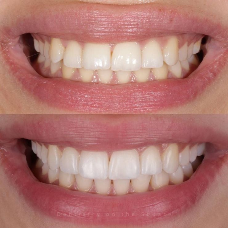 Transforming Smiles