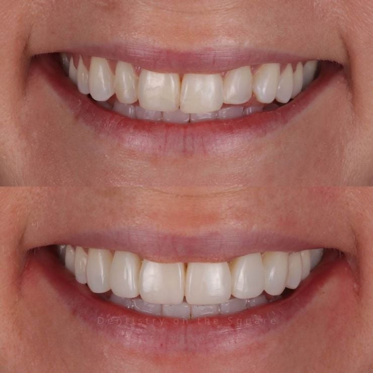 Dentistry On The Square, Pain Free Dentist Glasgow - Smile Gallery