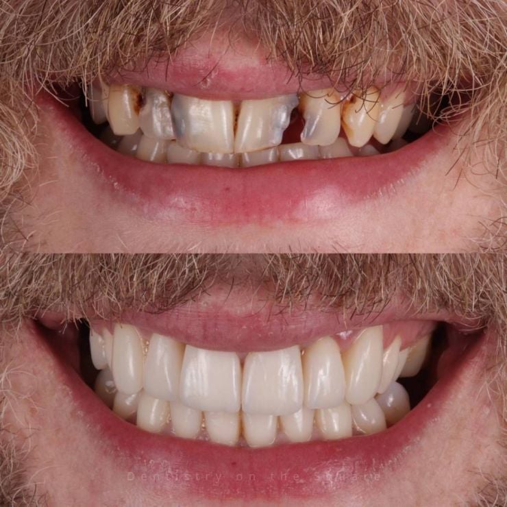 Transforming Smiles