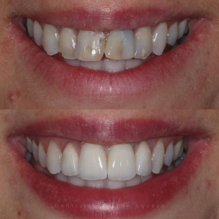 Dentistry On The Square, Pain Free Dentist Glasgow - Smile Gallery