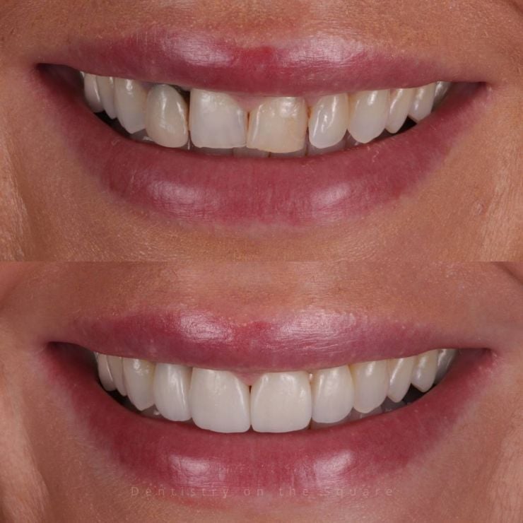 Dentistry On The Square, Pain Free Dentist Glasgow - Smile Gallery