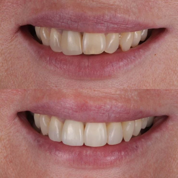 Dentistry On The Square, Pain Free Dentist Glasgow - Smile Gallery