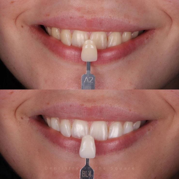 Transforming Smiles