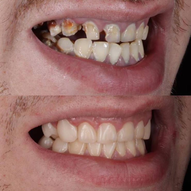 Transforming Smiles