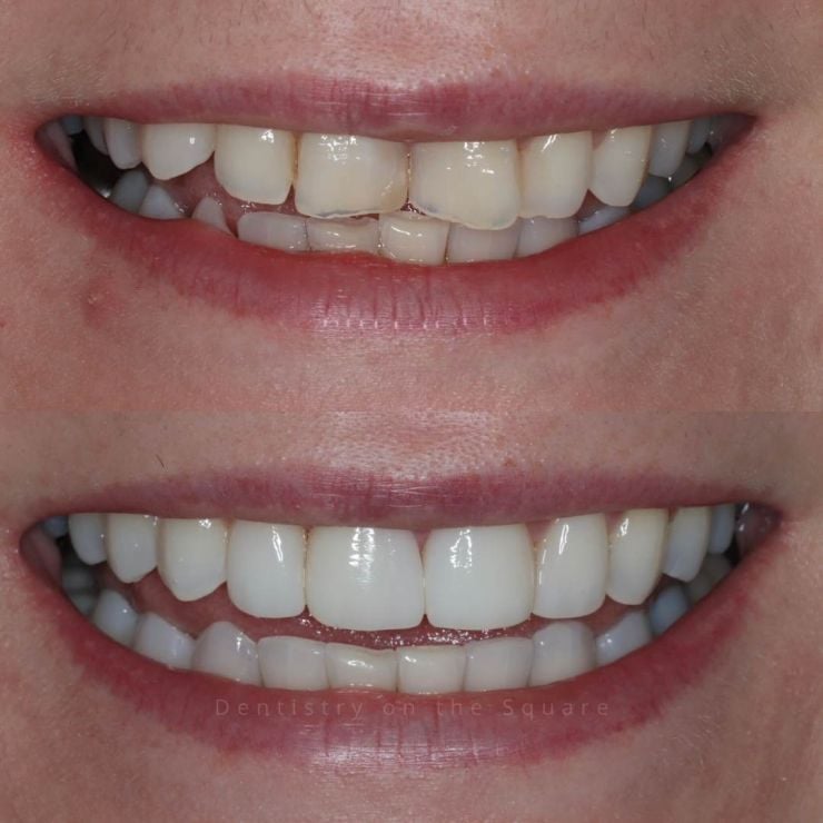 Dentistry On The Square, Pain Free Dentist Glasgow - Smile Gallery