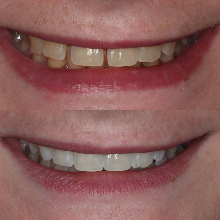 Transforming Smiles
