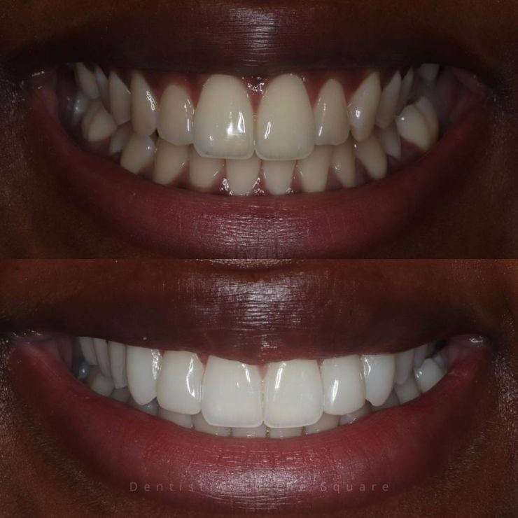 Transforming Smiles