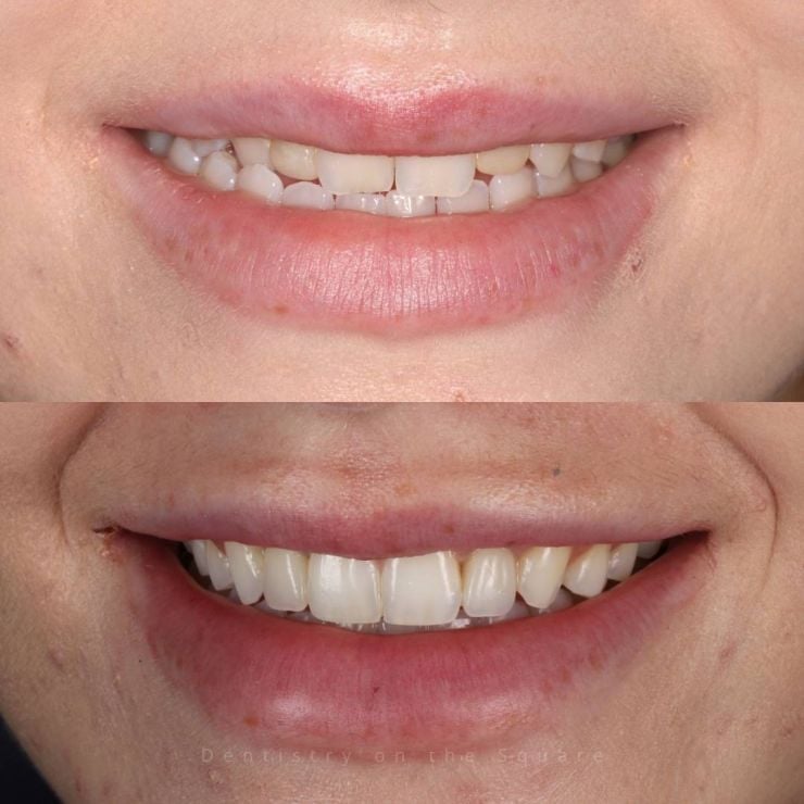 Transforming Smiles