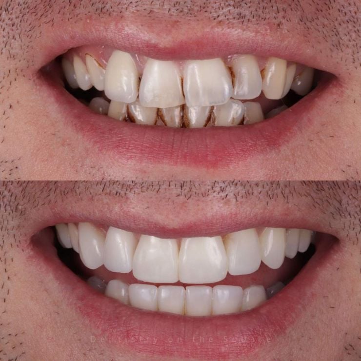 Transforming Smiles