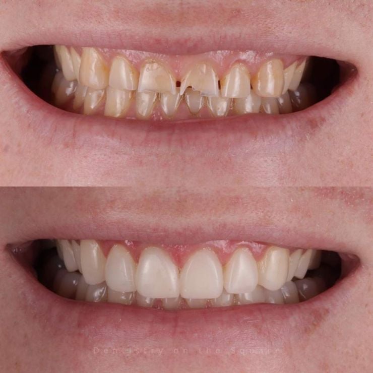 Transforming Smiles