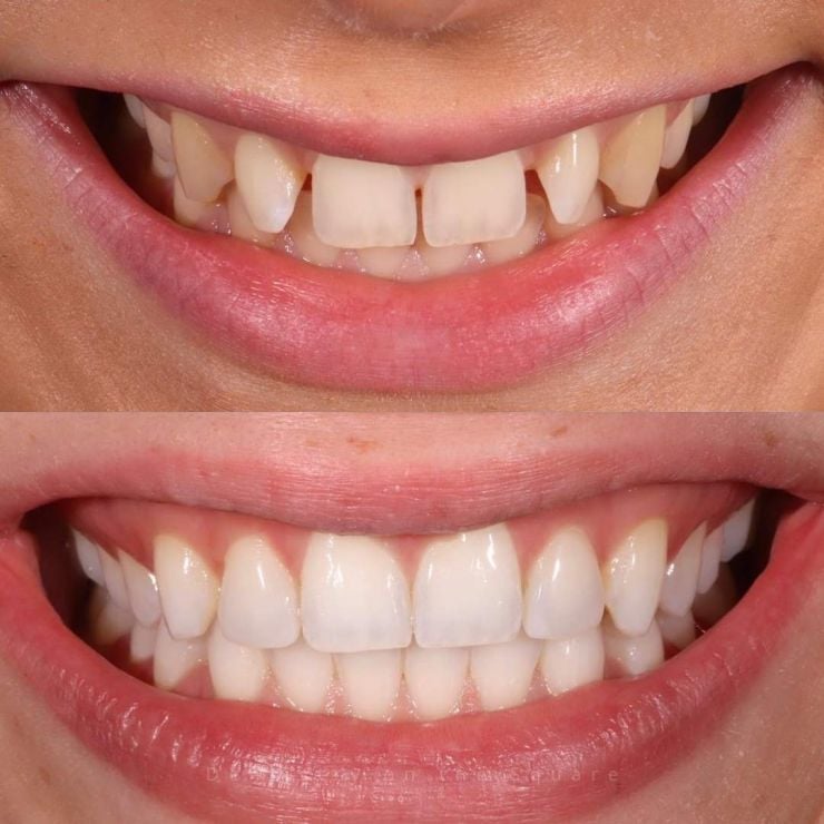 Dentistry On The Square, Pain Free Dentist Glasgow - Smile Gallery