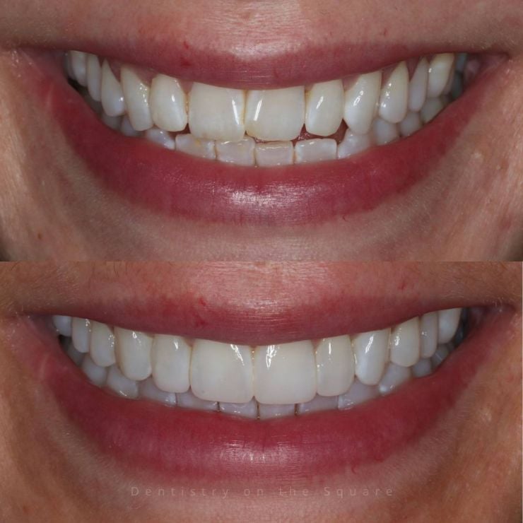 Dentistry On The Square, Pain Free Dentist Glasgow - Smile Gallery